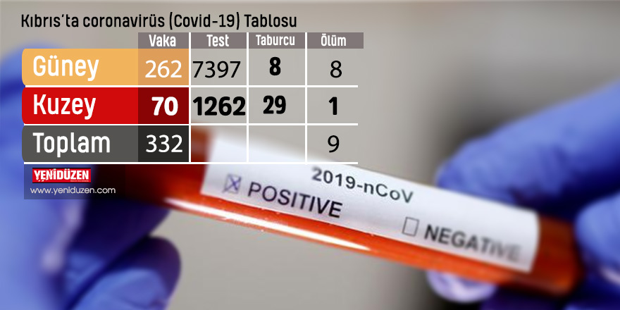 Kıbrıs'ta 332 vaka, 9 ölüm