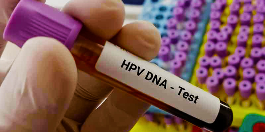 Sağlık Bakanlığı, kanser tarama sonuçlarını açıkladı: HPV taramasında yüzde 5 pozitiflik