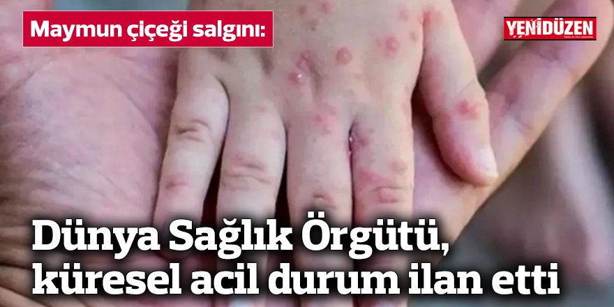 Dünya Sağlık Örgütü, küresel acil durum ilan etti