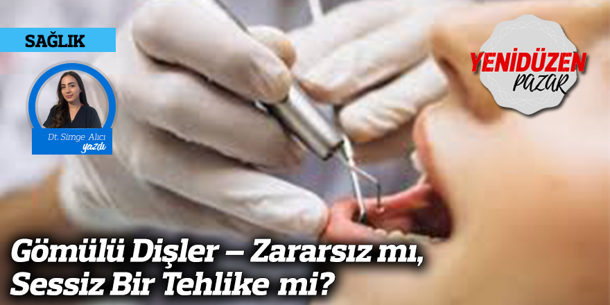 Gömülü Dişler – Zararsız mı, Sessiz Bir Tehlike mi?