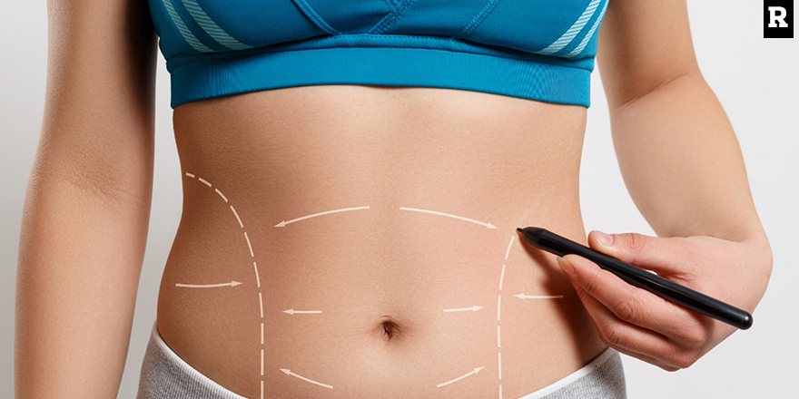 Karın Germe Ameliyatı ile Düz ve Sıkı Bir Karın