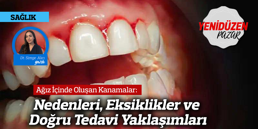 Ağız İçinde Oluşan Kanamalar: Nedenleri, Eksiklikler ve Doğru Tedavi Yaklaşımları