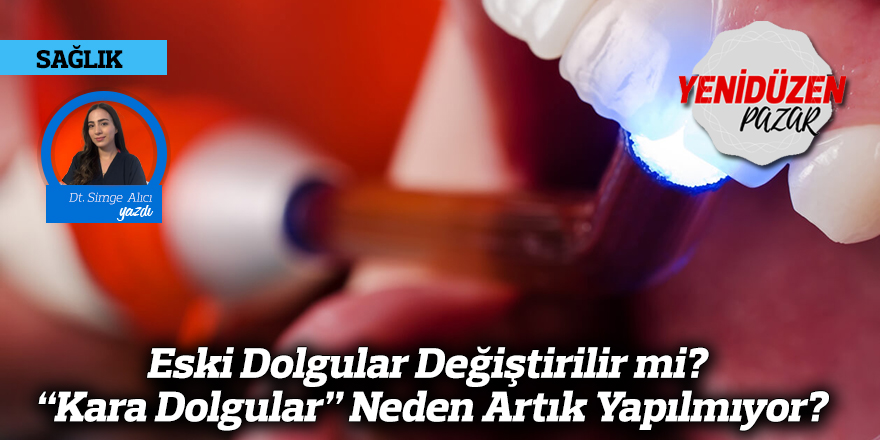 Eski Dolgular Değiştirilir mi? “Kara Dolgular” Neden Artık Yapılmıyor?