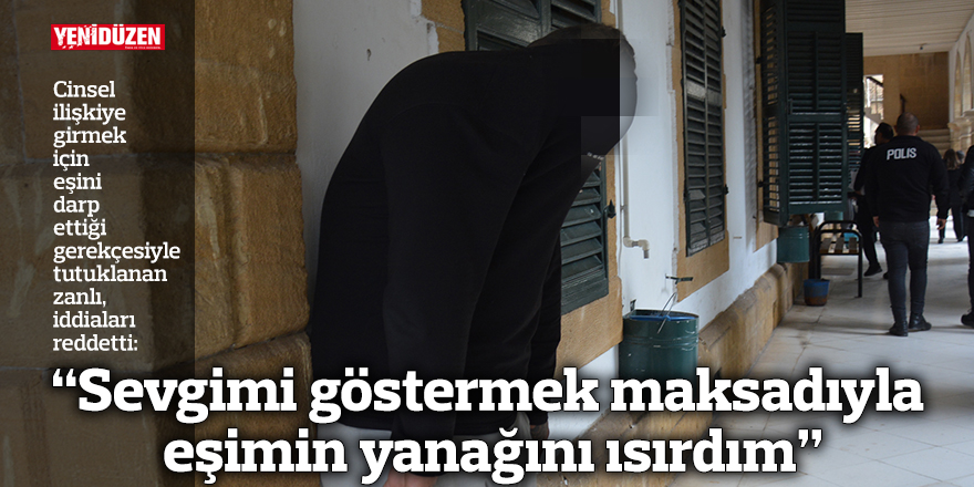 “Sevgimi göstermek maksadıyla eşimin yanağını ısırdım”