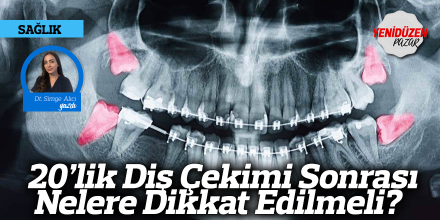 20’lik Diş Çekimi Sonrası Nelere Dikkat Edilmeli?
