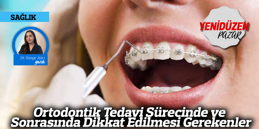 Ortodontik Tedavi Sürecinde ve Sonrasında Dikkat Edilmesi Gerekenler