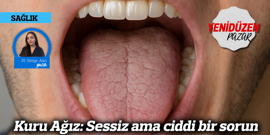 Kuru Ağız: Sessiz ama ciddi bir sorun