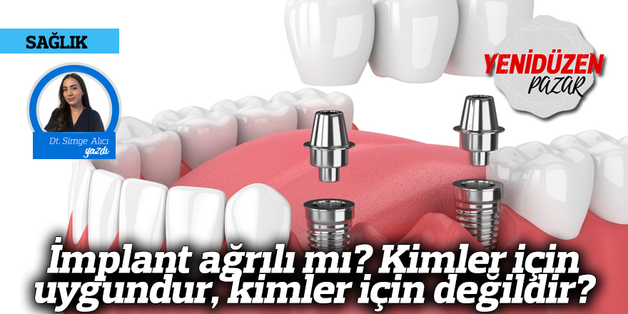 İmplant ağrılı mı? Kimler için uygundur, kimler için değildir?