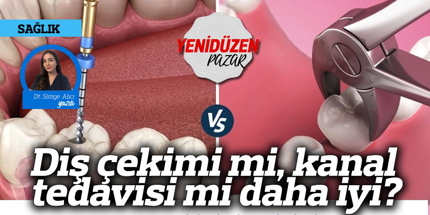 Diş çekimi mi, kanal tedavisi mi daha iyi?