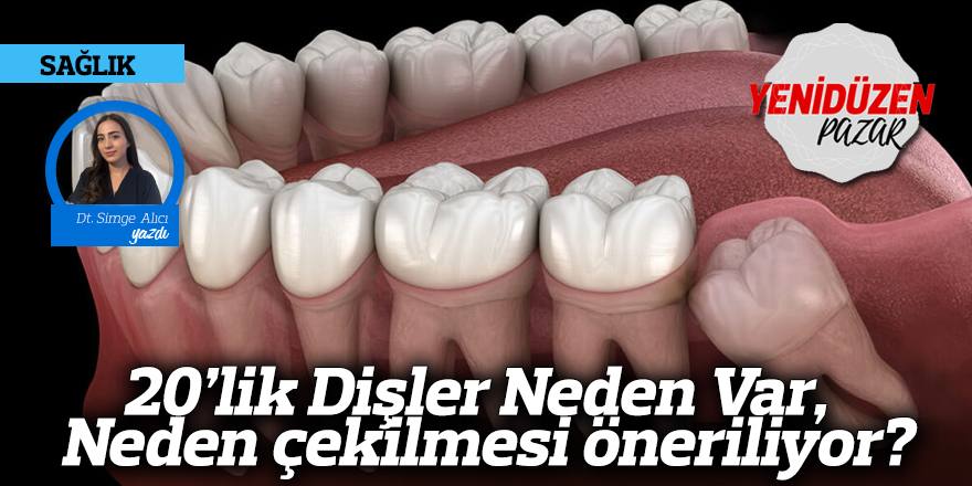 20’lik Dişler Neden Var, Neden çekilmesi öneriliyor?