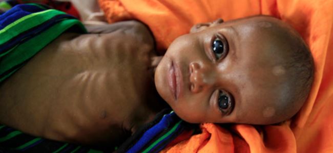 Somalide 6 çocuk açlıktan öldü