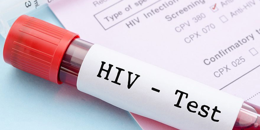 Farklı yıllarda tanı almış hayatta olan 103 HIV hastası var