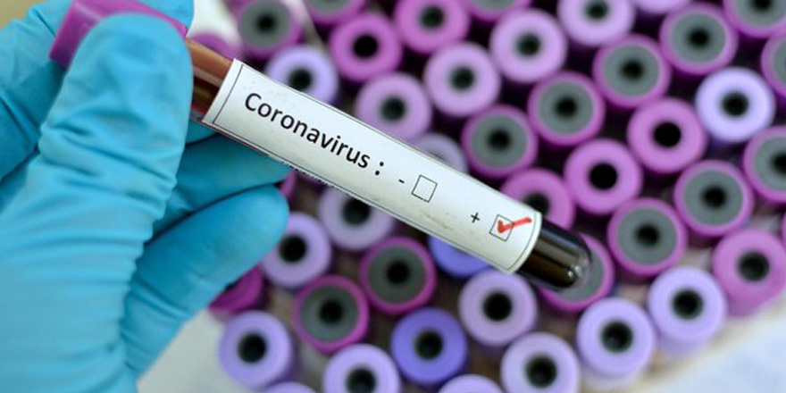 Türkiye’de Coronavirüsten ölenlerin sayısı 3’e yükseldi