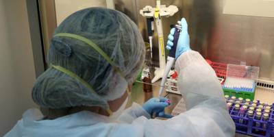 COVID-19: 97 pozitif vaka