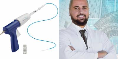 Ameliyatsız varis tedavisi yöntemi YDÜ’de başladı