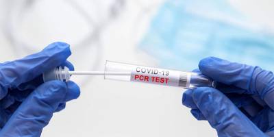 'PCR test ücreti 100TL, uymayana yasal işlem'