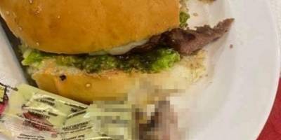 Hamburgerin içinden insan parmağı çıktı