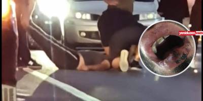 “4 dişim kırıldı, dudağım patladı ama zanlı serbest bırakıldı”