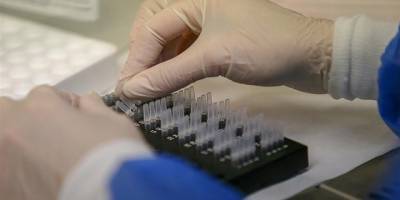 “Ülkede vaka bildirimi yok, şüphelendiğimiz hasta da olmadı”