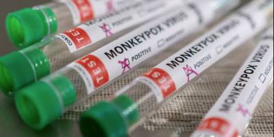 Güneyde Maymun Çiçeği Virüsü nedeniyle alarma geçildi