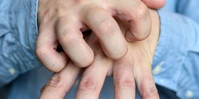 Tabipler Birliği: Uyuz hastalığında artış yaşanıyor