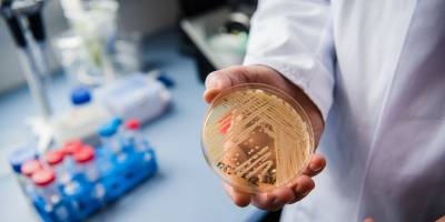 Candida auris mantarıyla yapay zeka desteği ile mücadele edilecek