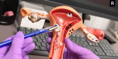 Rahim Filmi Nedir? Rahim Filmi Nasıl Yapılır?