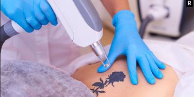 İstanbul'daki En İyi 10 Dövme Silme ve Sildirme Merkezleri ve Fiyatları 2024