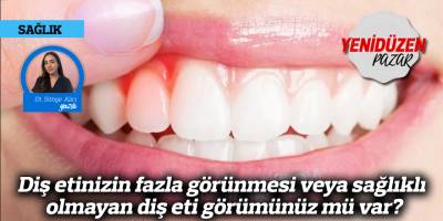 Diş etinizin fazla görünmesi veya sağlıklı olmayan diş eti görümünüz mü var?