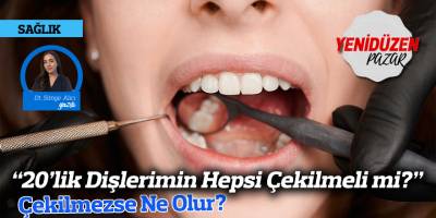 “20’lik Dişlerimin Hepsi Çekilmeli mi?” Çekilmezse Ne Olur?