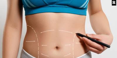 Karın Germe Ameliyatı ile Düz ve Sıkı Bir Karın