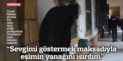 “Sevgimi göstermek maksadıyla eşimin yanağını ısırdım”