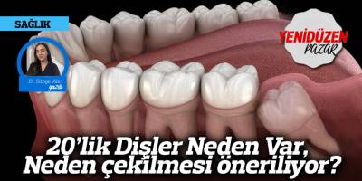 20’lik Dişler Neden Var, Neden çekilmesi öneriliyor?