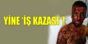 Vatandaşın ‘duyarsızlığının’ bedelini işçi ödedi!