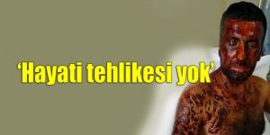 Ercan Aka’nın tedavisi sürüyor