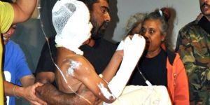 Soba faciası… 4 yaralı!