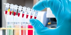 Mart ayında analitik bulgu yok