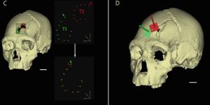 En eski cinayet ortaya çıktı
