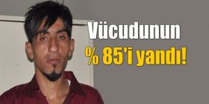 Yine iş kazası… Hayati tehlikesi var