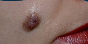 “Atipik Benler” hakkında panel düzenleniyor