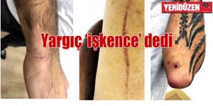 KUNDAKLAMA SORUŞTURMASI