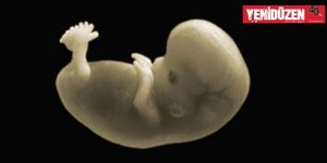 Mutfak bıçağıyla sezaryen yaptı 100 yıl aldı