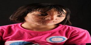 Leave Us Alone/Bizi Rahat Bırakın