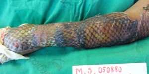 Tıp tarihinde bir ilki gerçekleştirdiler