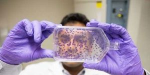 İnsan midesine ait dokular geliştirildi