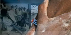 “Dünya İnsani Yardım Günü” Çağrısı