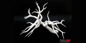 YDÜ Hastanesi'nde “Üç Boyutlu” dönem başladı!