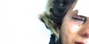 YİNE KADINA ŞİDDET