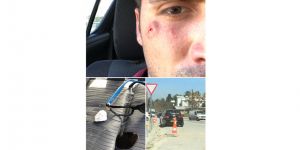 Yoldan fırlayan taş gözünü çıkarıyordu!