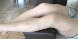 Girne’nin kabusu sinekler